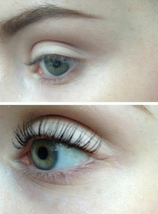 LvL lash Lift Renew Skin Clinic
