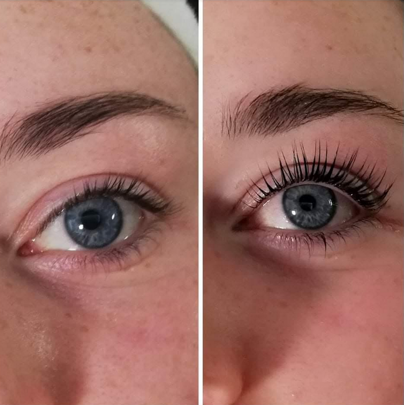 LvL lash Lift Renew Skin Clinic